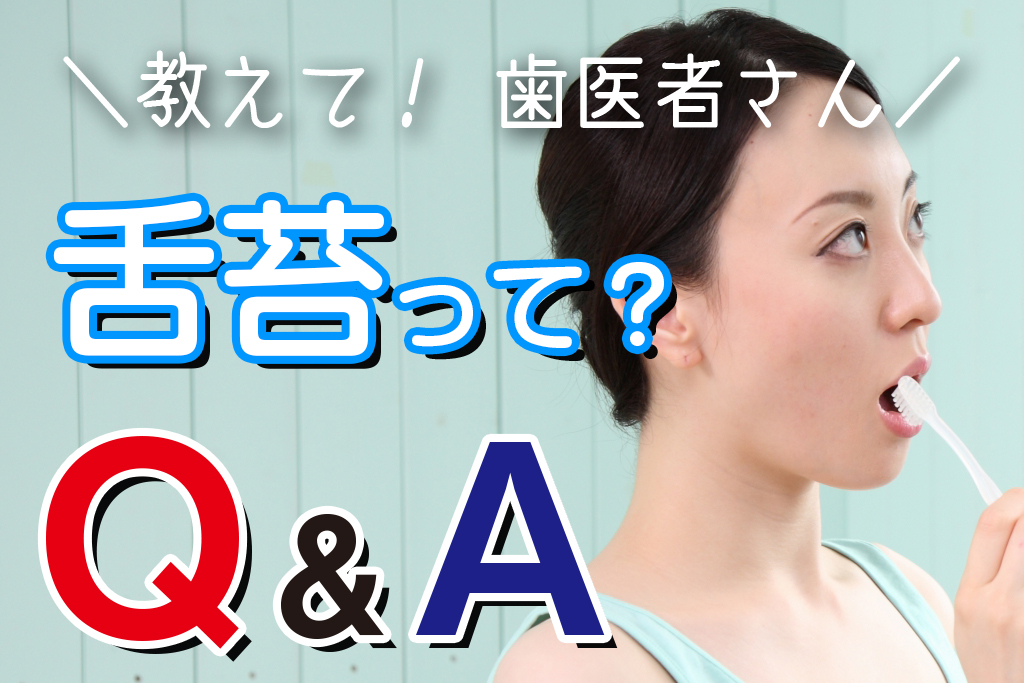 教えて歯医者さん-舌苔